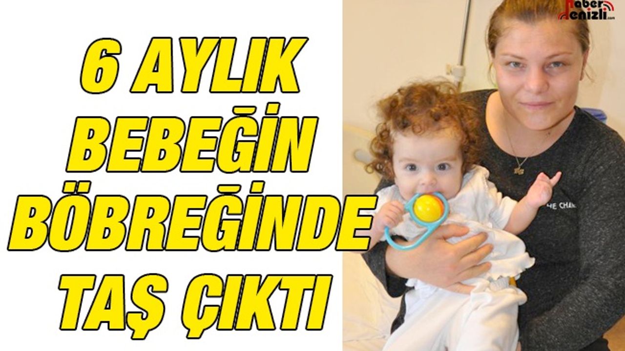 6 Aylık Bebeğin Böbreğinde Taş Çıktı