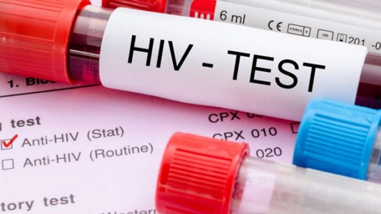 HIV Aşısı Nedir? - Denizli Haber - Haberdenizli.com » Güncel Denizli ...