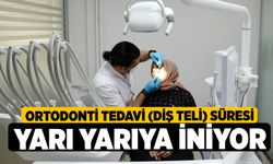 Ortodonti Tedavi (Diş Teli) Süresi Yarı Yarıya İniyor