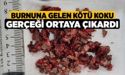 Burnuna Gelen Kötü Koku Gerçeği Ortaya Çıkardı