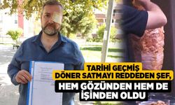 Tarihi geçmiş döner satmayı reddeden şef, hem gözünden hem de işinden oldu