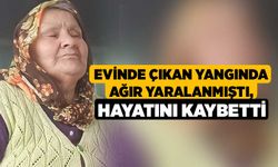 Evinde Çıkan Yangında Ağır Yaralanmıştı, Hayatını Kaybetti