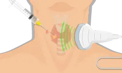 Biyopsi Nedir ve Hangi Durumlarda Yapılır?