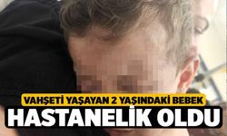 Annesinin erkek arkadaşı tarafından dövüldüğü iddia edilen bebek tedavi altına alındı