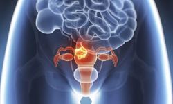 Mesane Tümörü Ameliyatı