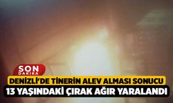 Denizli'de Tinerin Alev Alması Sonucu 13 Yaşındaki Çırak Ağır Yaralandı