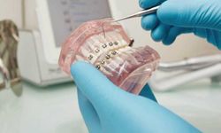 Dentopia ile Sağlıklı Gülüşlerin ve Mükemmel Dişlerin Adresi