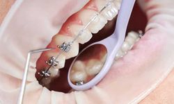 Dentopia: Sağlıklı Gülüşlerin Adresi