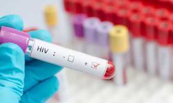 HIV Testi Nasıl Yapılır? Test Türleri, Süreç ve Sonuçlar