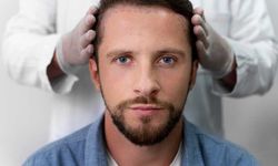 Antalya’da Estetik Uygulamalara İlgi Artıyor: Saç, Sakal ve Kaş Ekimi Alanında Dikkat Çeken Yükseliş