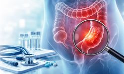 Rektum Kanseri Nedir? Belirtileri, Nedenleri ve Modern Tedavi Yöntemleri