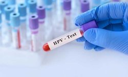 Cinsel Sağlığınızı Korumak İçin Bilmeniz Gerekenler