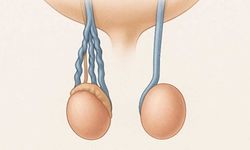 Testislerde Kitle: Belirtileri, Nedenleri ve Tedavi Yöntemleri