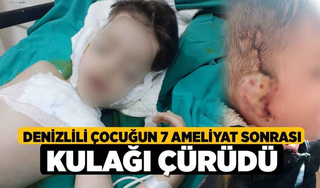 Denizlili Çocuğun 7 Ameliyat Sonrası Kulağı Çürüdü