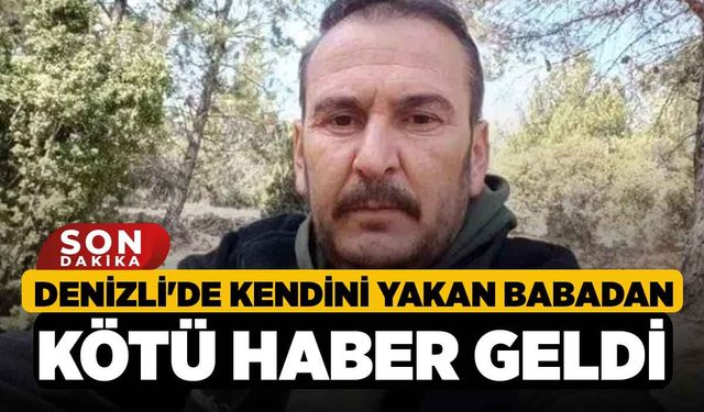 Denizli'de Kendini yakan babadan kötü haber geldi