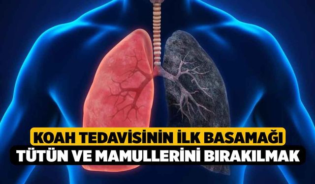 KOAH tedavisinin ilk basamağı tütün ve mamullerini bırakılmak