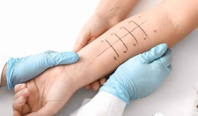 Alerji Testi ile Görünmeyen Düşmanları Keşfetmek için Yeni Bir Bakış