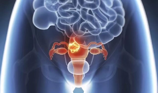 Mesane Tümörü Ameliyatı