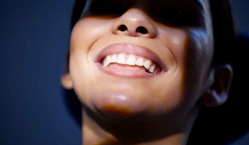 Hollywood Smile tam olarak nasıl bir değişim sağlar?