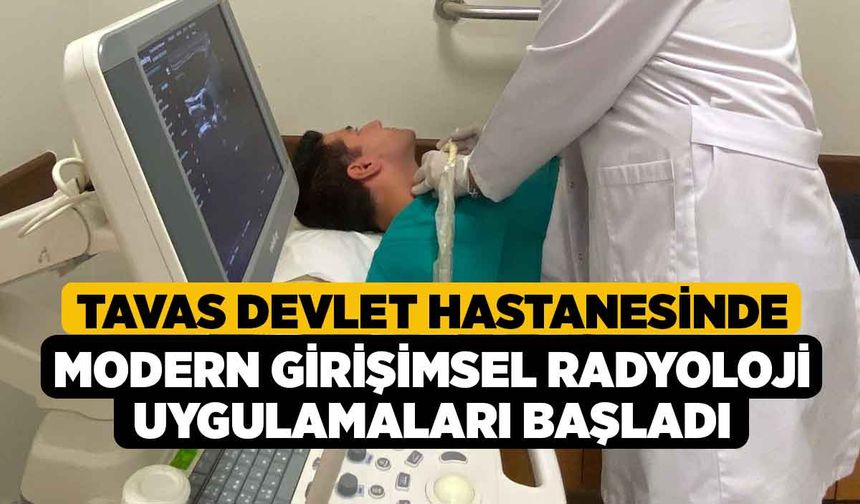 Tavas Devlet Hastanesinde modern girişimsel radyoloji uygulamaları başladı
