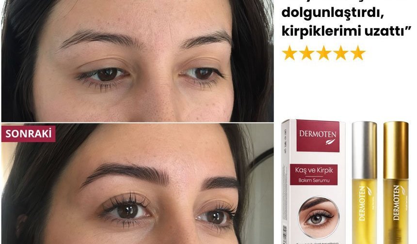 Neden Dermoten Kaş Kirpik Serumu En İyisi?
