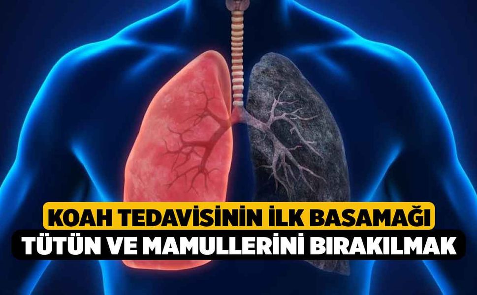 KOAH tedavisinin ilk basamağı tütün ve mamullerini bırakılmak