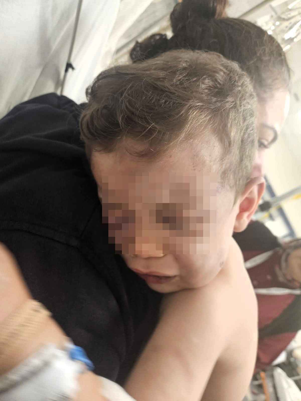 Denizli Bebek Darp Hastanelik Oldu2