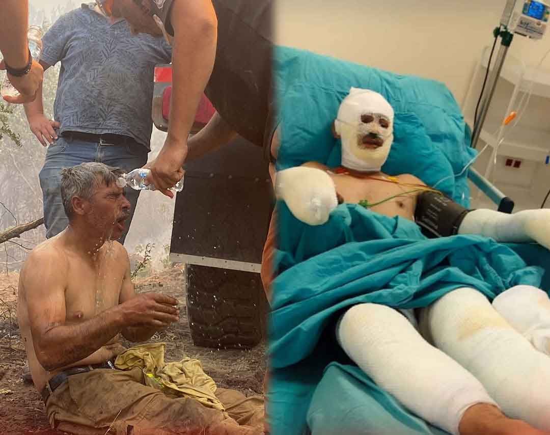 Denizli Orman Iscisi Kader Dereli Yangin Su Verin1