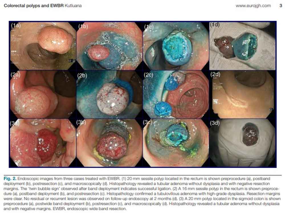 Turk Bilim Insaninin Gelistirdigi Yeni Yontem Uluslararasi Tip Camiasinda Kabul Gordu 1