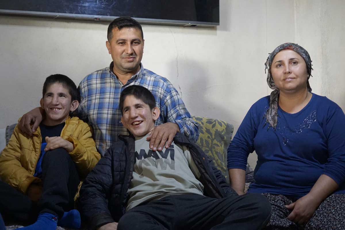 Civrilli Ikizler 15 Milyonda 1 Gorulen Hastalikla Yasiyor2