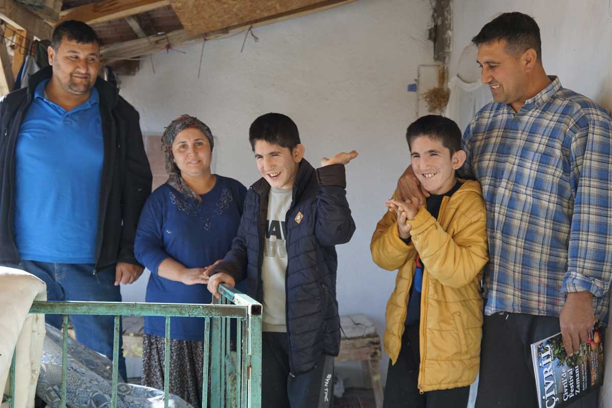 Civrilli Ikizler 15 Milyonda 1 Gorulen Hastalikla Yasiyor4