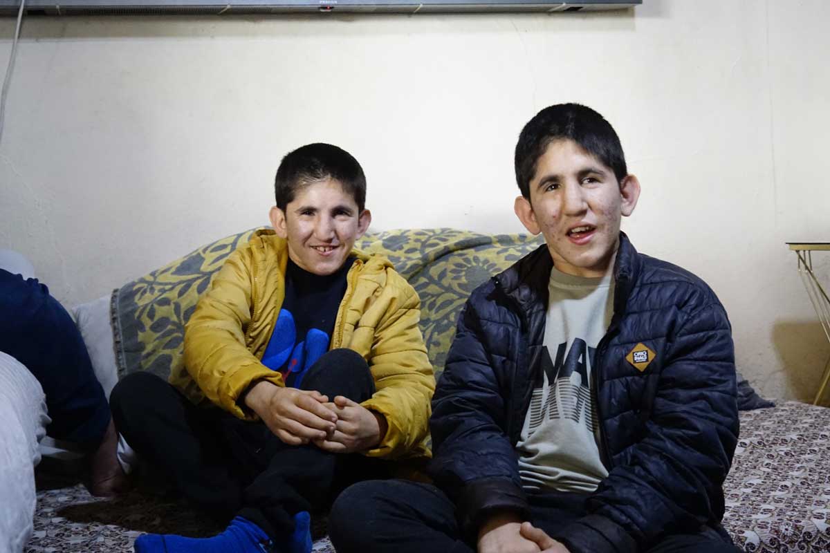 Civrilli Ikizler 15 Milyonda 1 Gorulen Hastalikla Yasiyor5