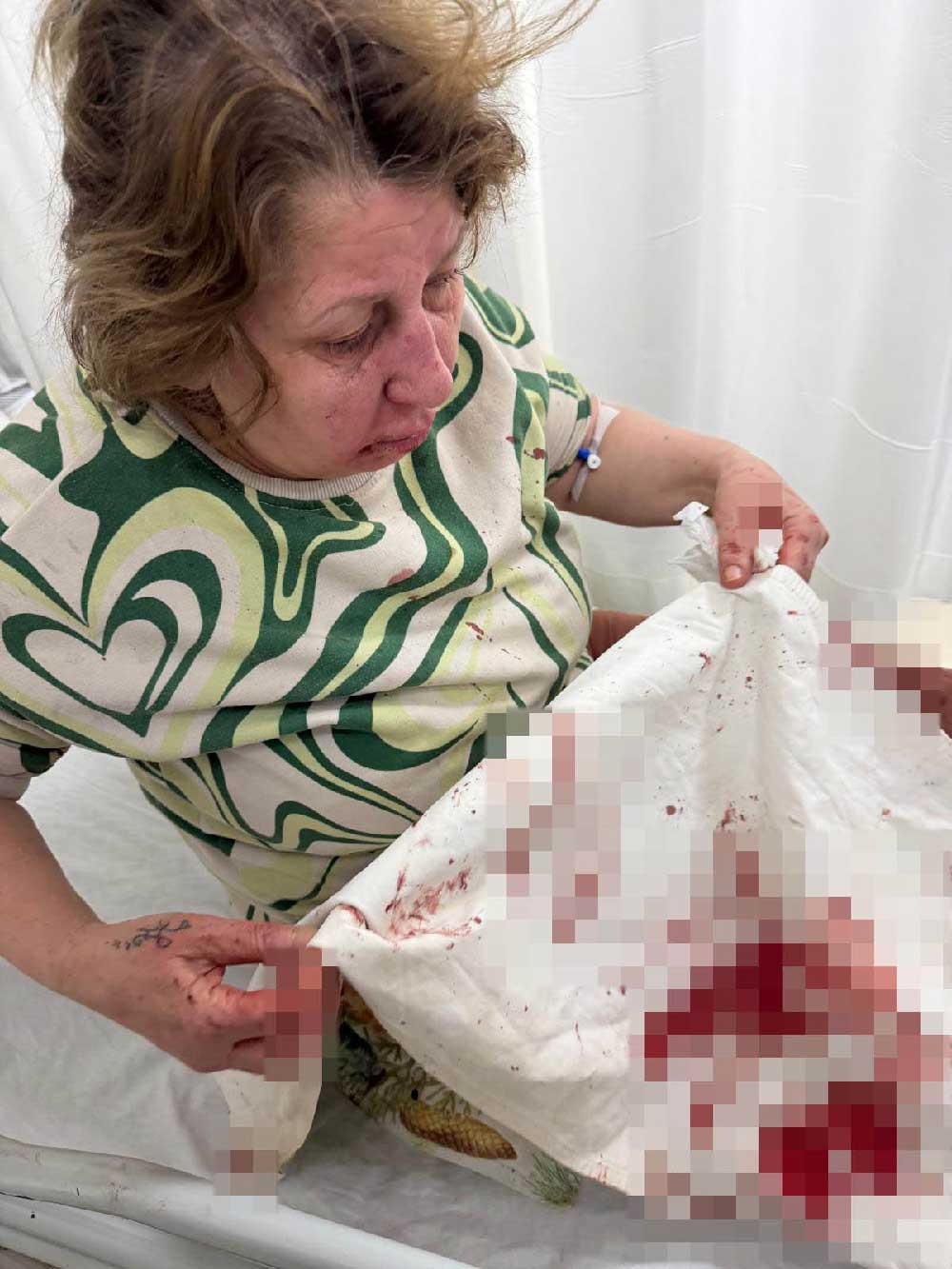 Denizlide Gurultuden Rahatsiz Oldugu Icin Komsusunu Uyaran Kadin Darp Edildi 1