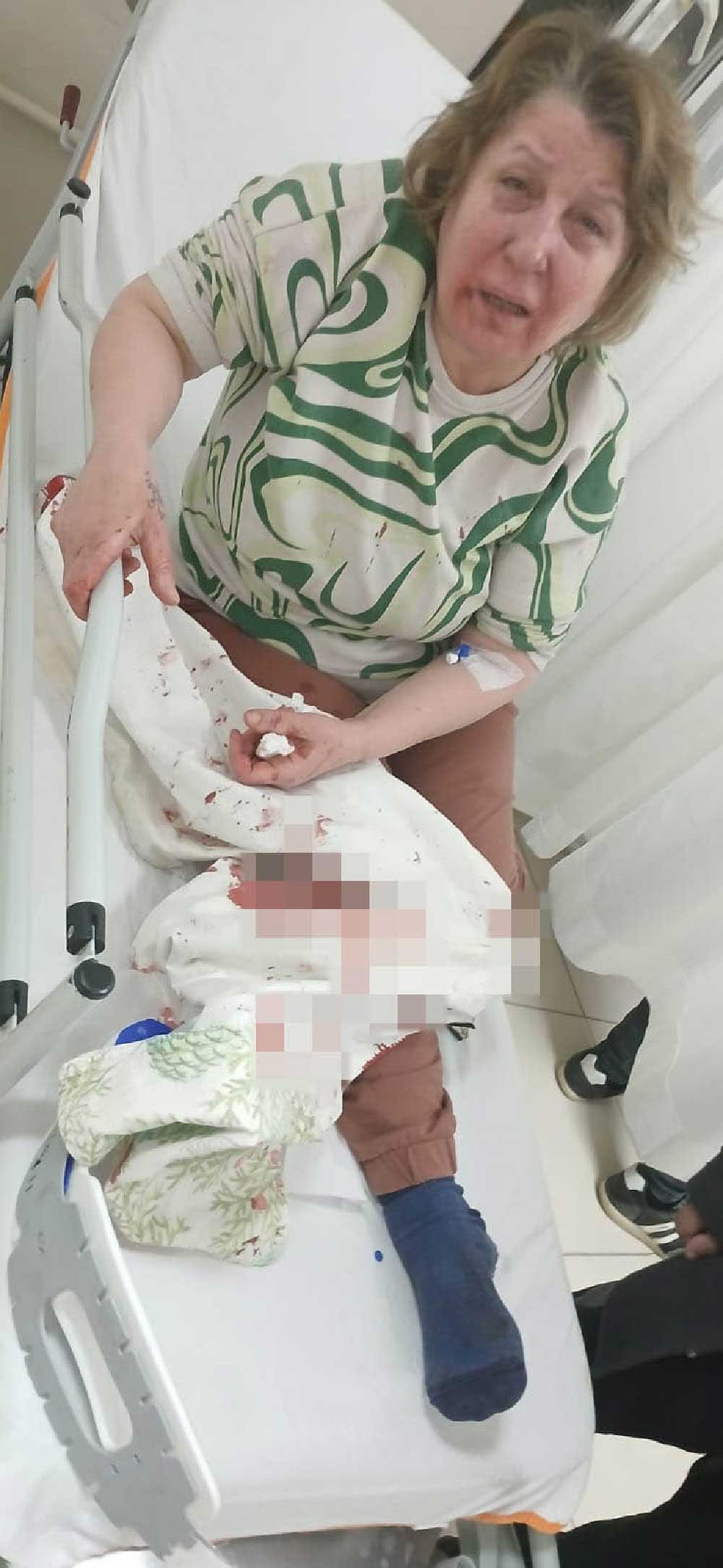 Denizlide Gurultuden Rahatsiz Oldugu Icin Komsusunu Uyaran Kadin Darp Edildi 2