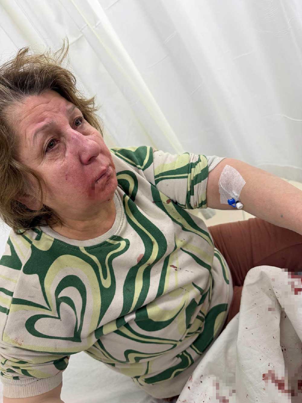 Denizlide Gurultuden Rahatsiz Oldugu Icin Komsusunu Uyaran Kadin Darp Edildi 3