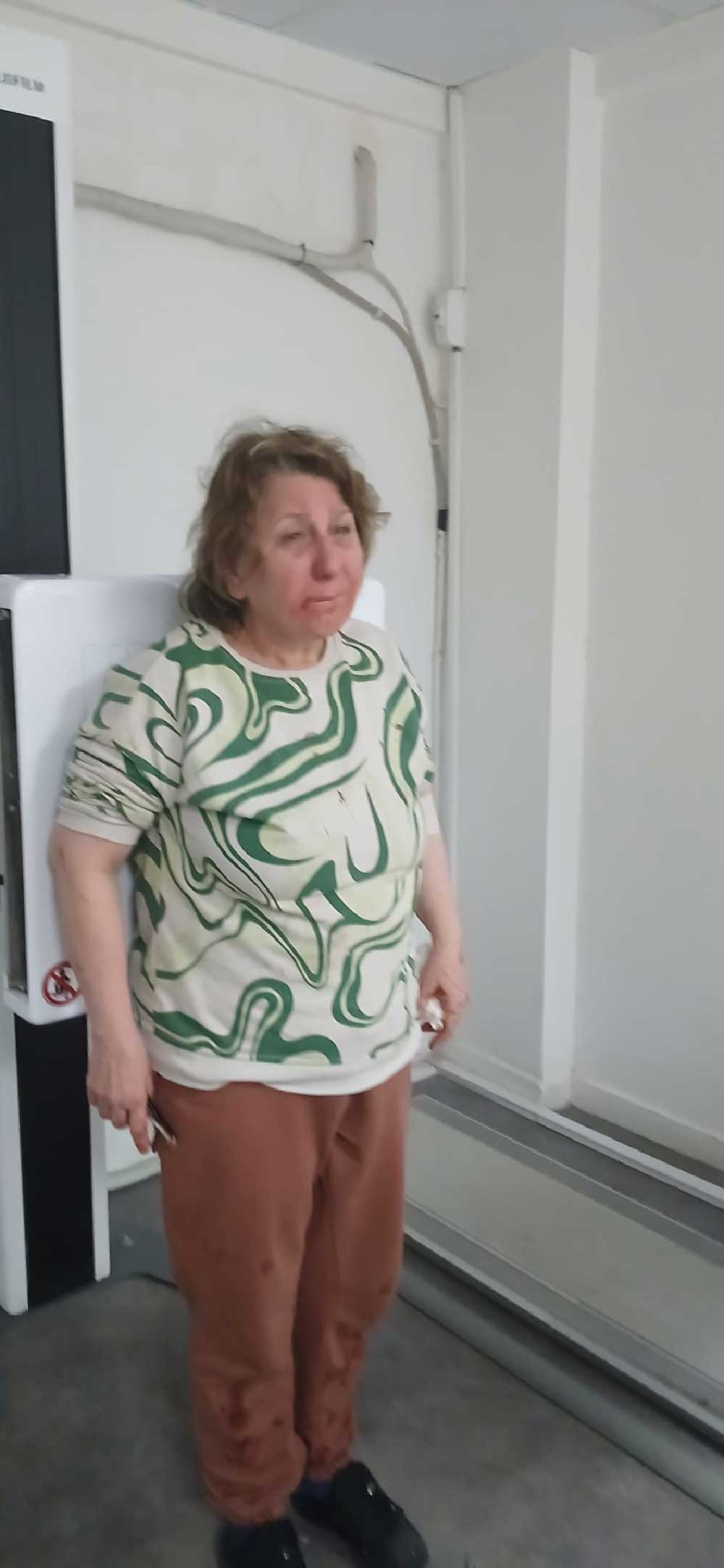 Denizlide Gurultuden Rahatsiz Oldugu Icin Komsusunu Uyaran Kadin Darp Edildi 4